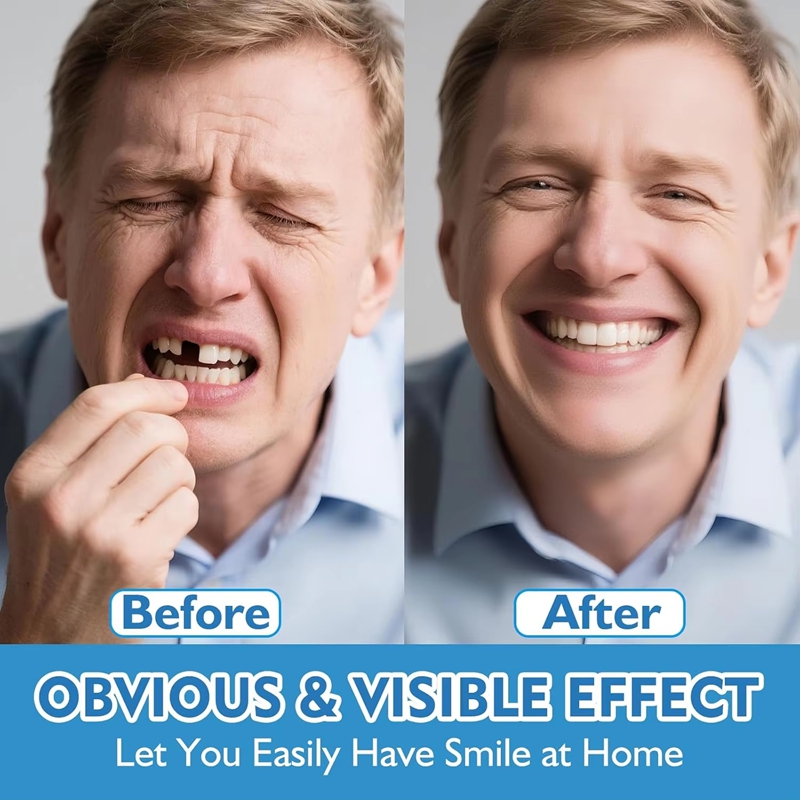 Gigi Palsu Silikon Lengkap Ata - Teeth Whitening Instant ulasan dan harga