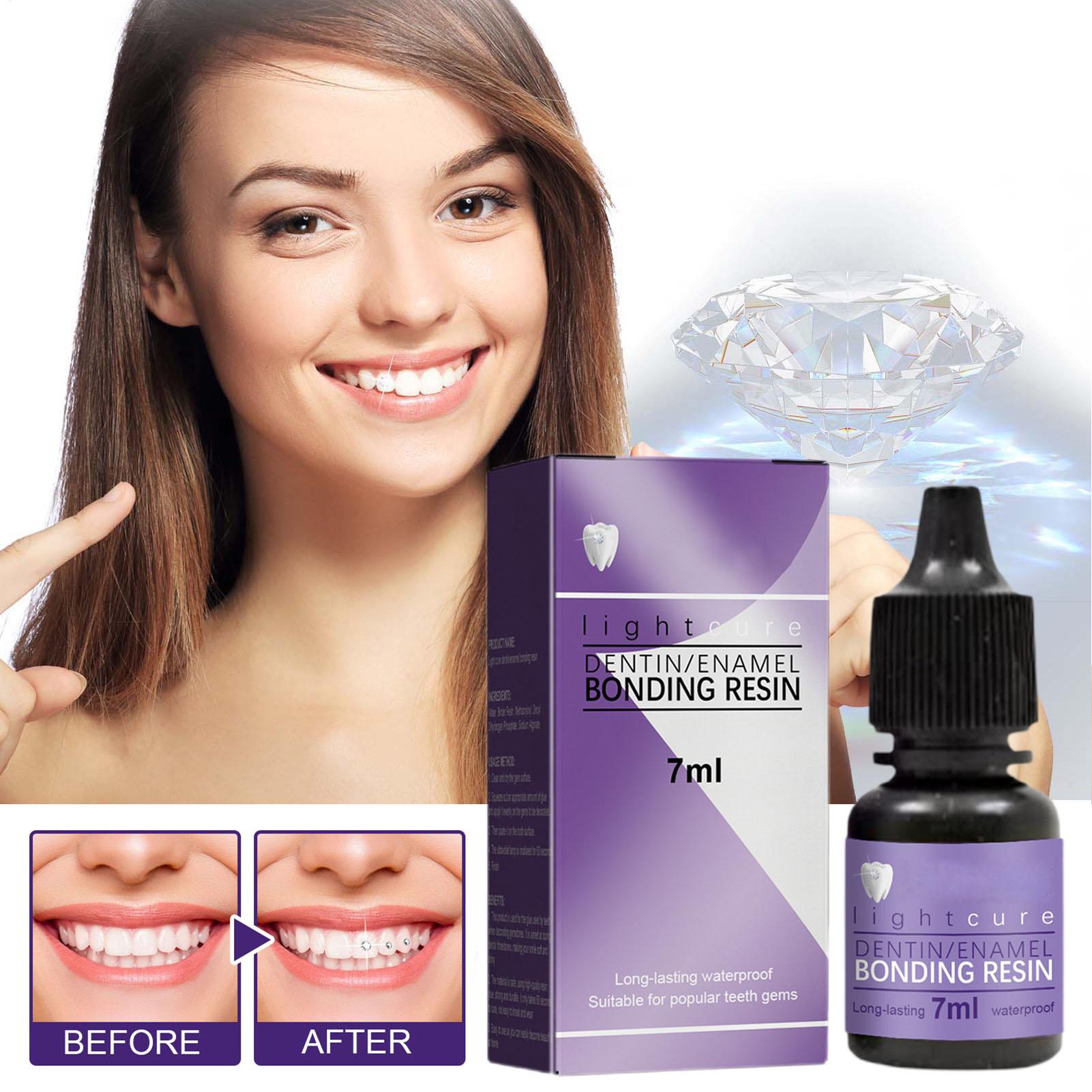 Lem Perekat Gigi 7ml untuk Per - Tooth Gem Kit ulasan dan harga