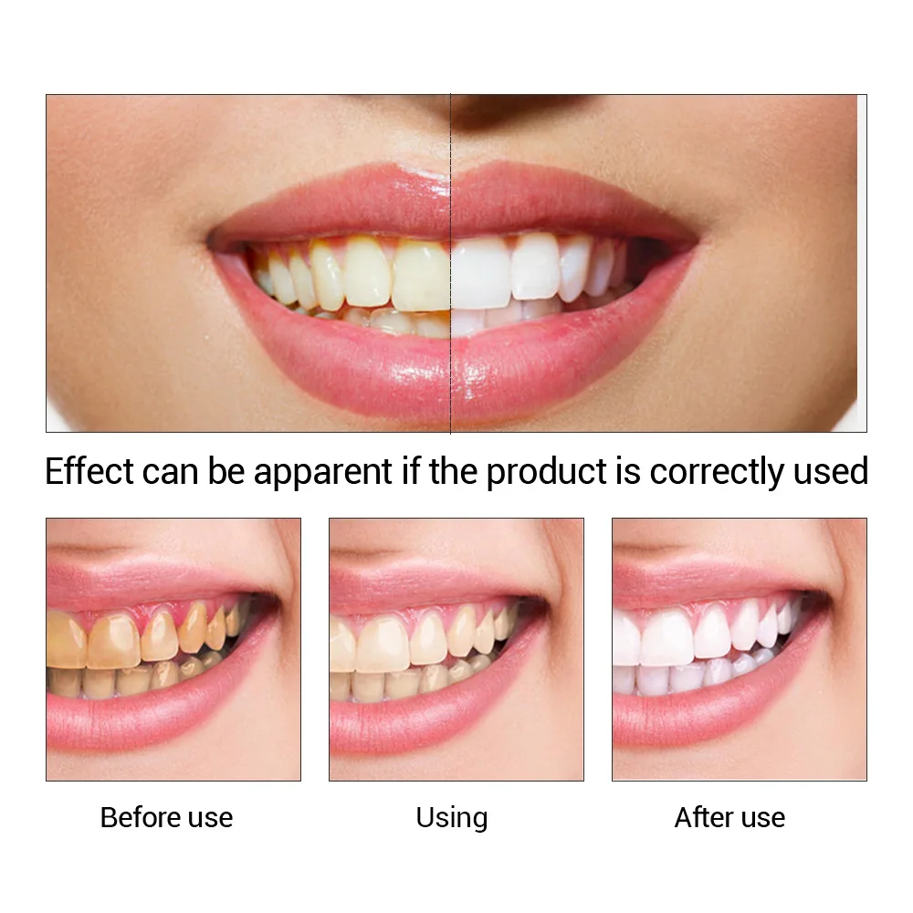 FTEENPLY Bubuk Esensi Pemutih  - Teeth Whitening Diy ulasan dan harga