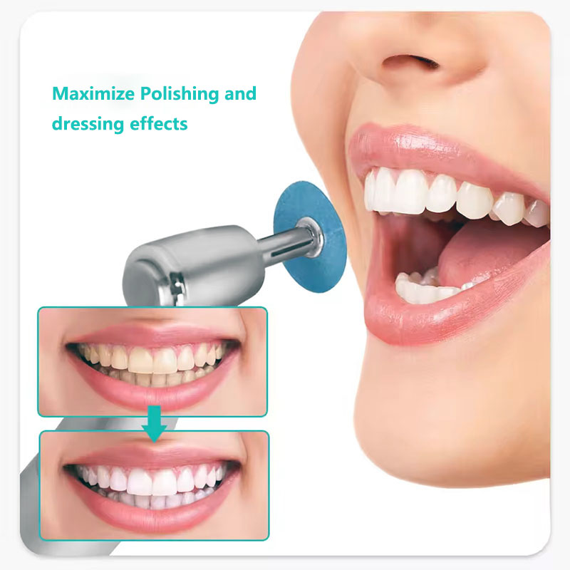 40 Buah Cakram Pemoles Gigi Ba - Teeth Whitening Home ulasan dan harga