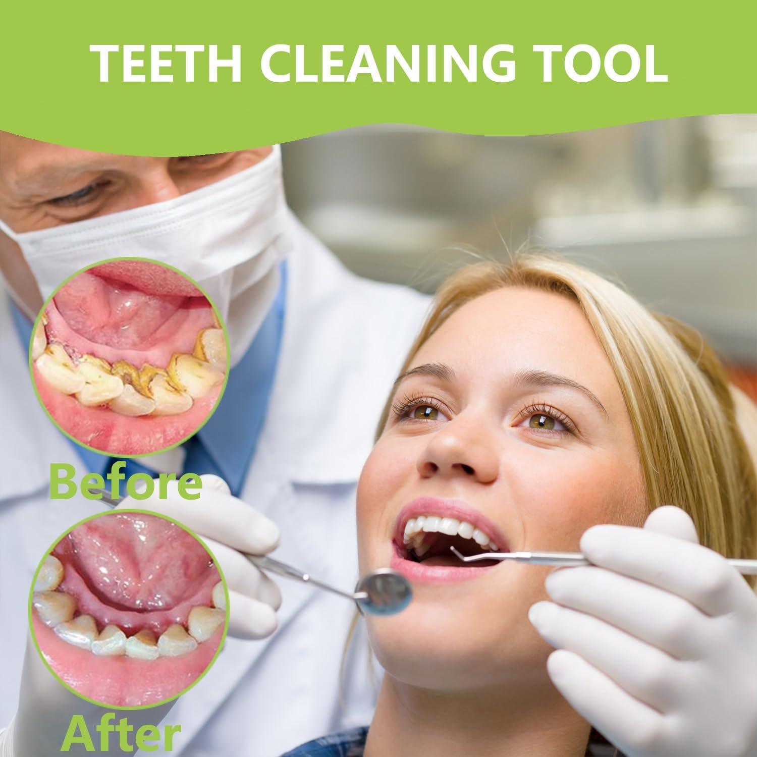 Alat Perawatan Gigi Profesiona - Teeth Whitening Machine Professional ulasan dan harga