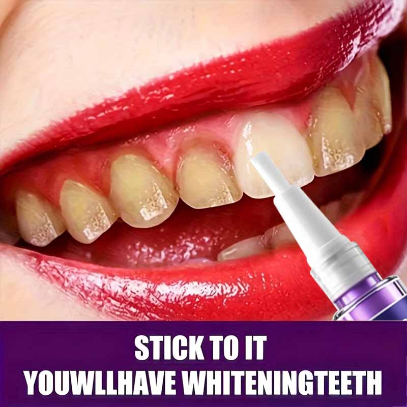 ROZINO 9D Pena Pemutih Gigi Ni - Teeth Whitening Pen ulasan dan harga