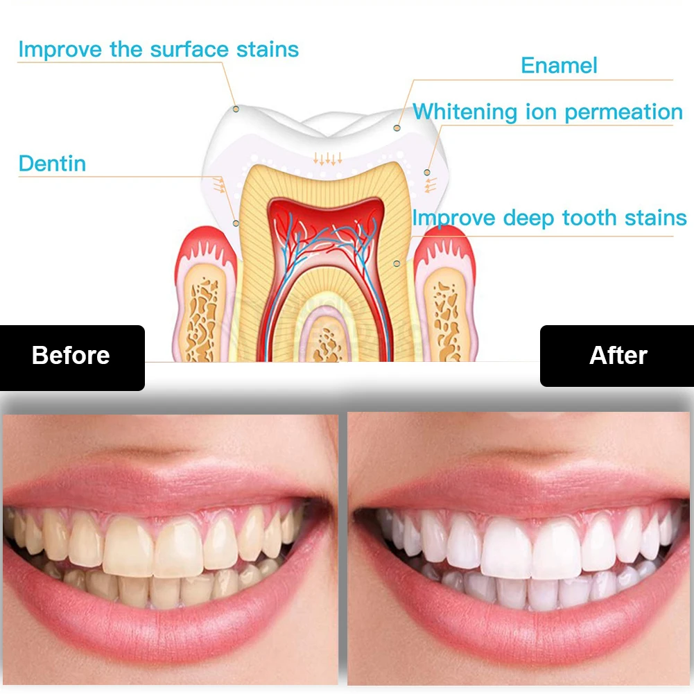 Kit pemutih gigi Mini 16 LED c - Teeth Whitening Pen ulasan dan harga